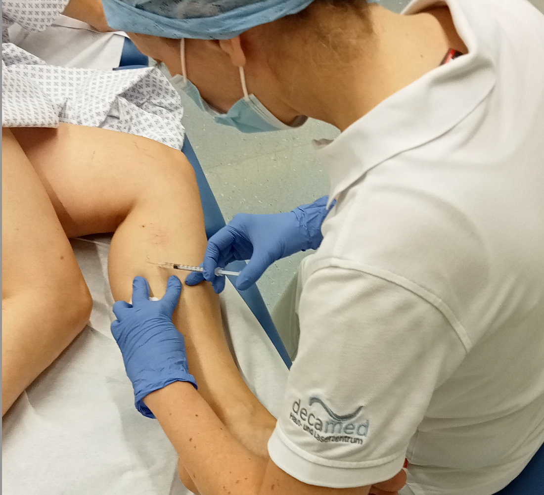 Sklerotherapie verstehen.