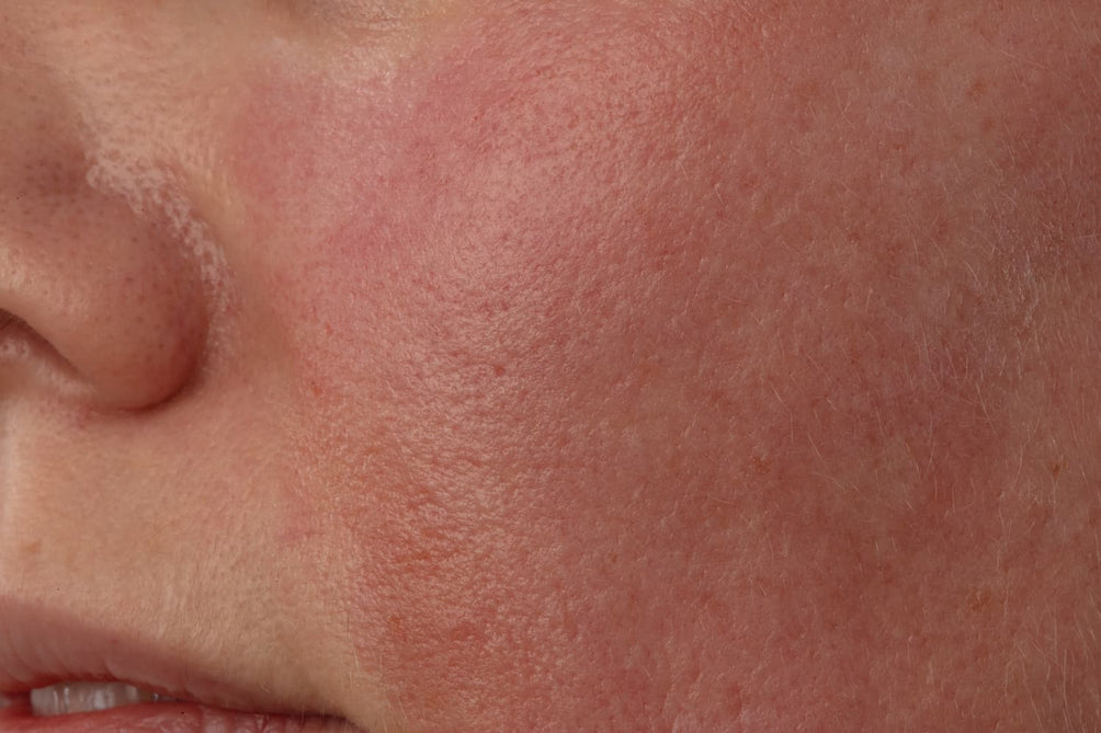 Decalys Skincare