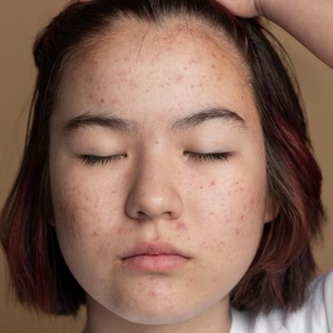 Decalys Skincare